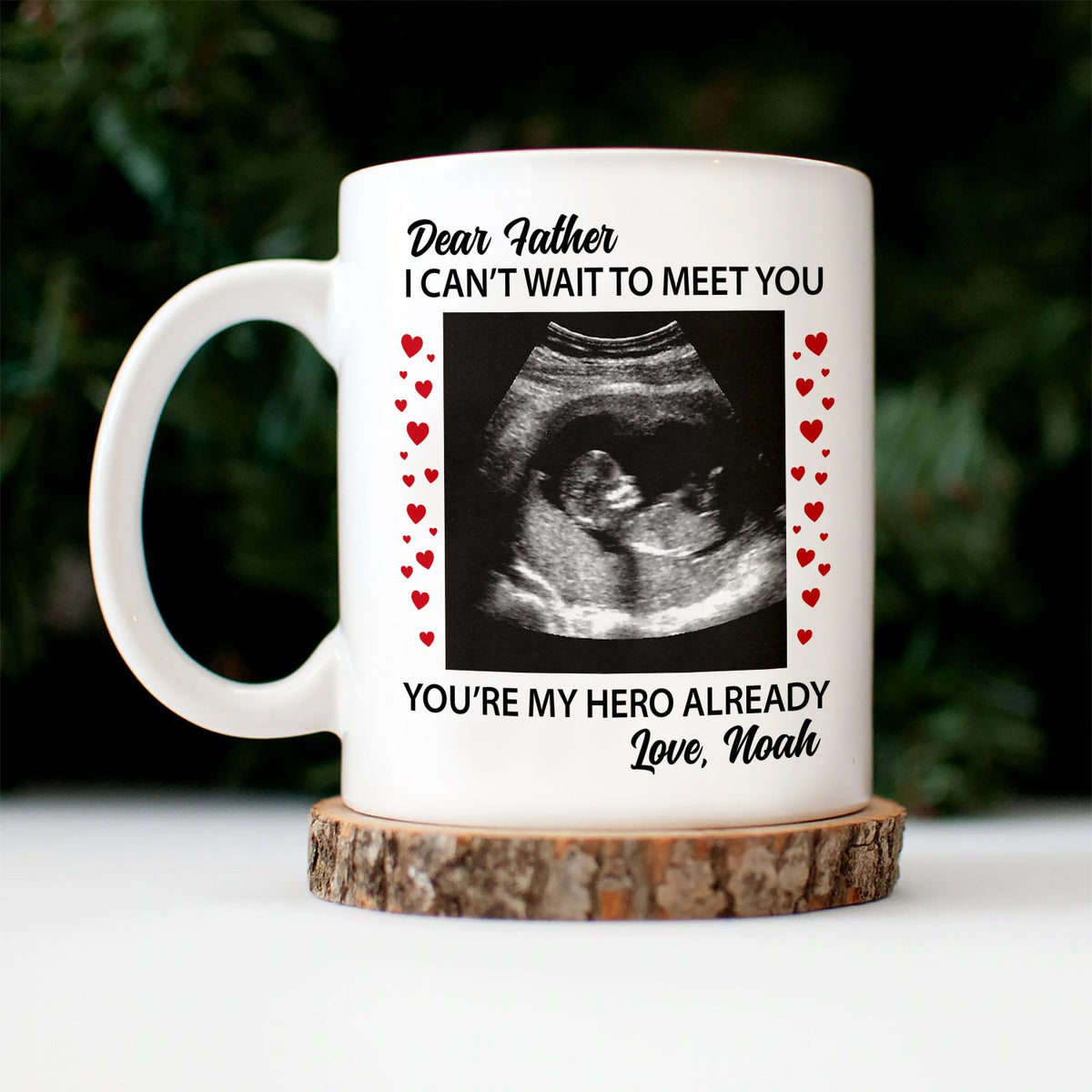 Custom Photo Baby Bump Can't Wait To Meet You - Pregnancy Gift - Personalized Mug
