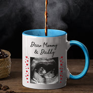 Custom Photo Calendar Can't Wait To Meet You - Gift For Mother, Father - Personalized Accent Mug